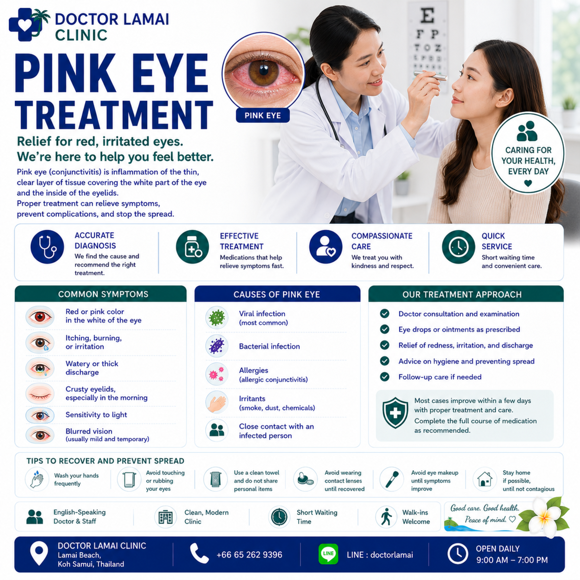 Pink Eye Treatment Koh Samui. The 2026 Guide to Curing Eye Infections Fast