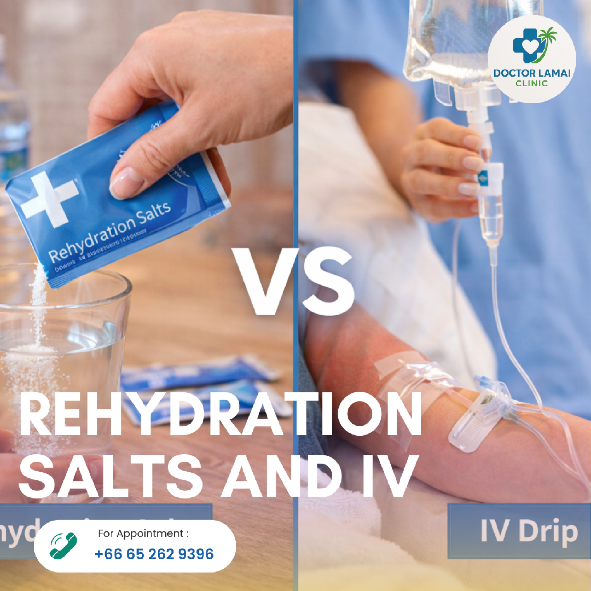 Rehydration Salts vs IV Drip. The 2026 Traveler’s Battle Guide