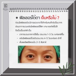 ปัญหาร่องใต้ตาลึก รักษาอย่างไร?