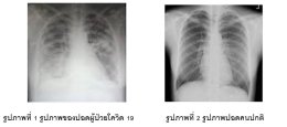 โควิด19 กับแพทย์แผนจีน