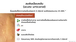 การรักษาลมพิษโดยศาสตร์แพทย์แผนจีน Urticaria