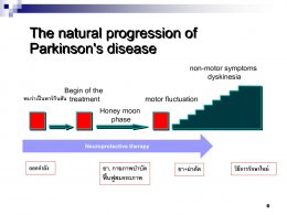 โรคพาร์กินสันกับการรักษาด้วยวิธีแพทย์แผนจีน 
