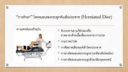 โรคหมอนรองกระดูกทับเส้นประสาท Herniated Disc