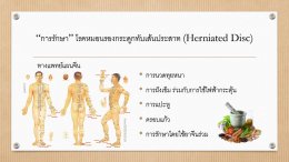 โรคหมอนรองกระดูกทับเส้นประสาท Herniated Disc