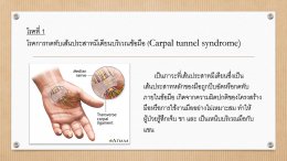 โรคการกดทับเส้นประสาทที่เกิดจากเส้นประสาทบริเวณข้อมือโดยตรง 