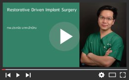 Restorative Driven Implant