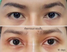 ตาสองชั้น