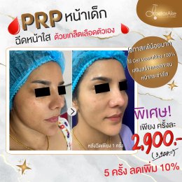 PRP