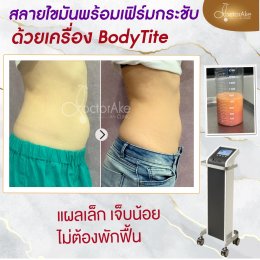 Body Tite
