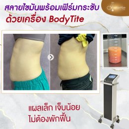 Body Tite