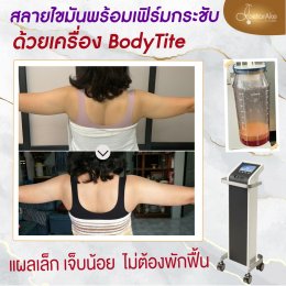 Body Tite