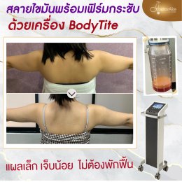 Body Tite