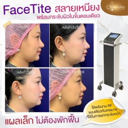 Face Tite