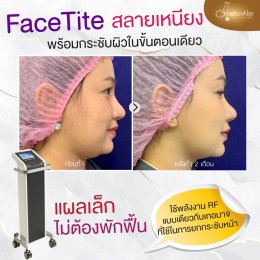Face Tite