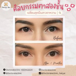 ตาสองชั้น