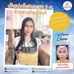 Filler ปรับรูปหน้า