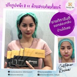 Filler ปรับรูปหน้า