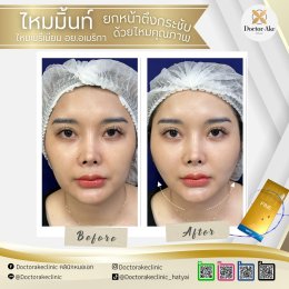 ร้อยไหม Premium Mint Lift