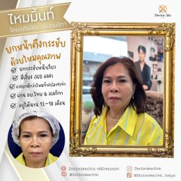 ร้อยไหม Premium Mint Lift