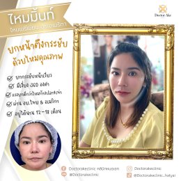 ร้อยไหม Premium Mint Lift