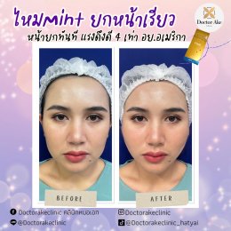 ร้อยไหม Premium Mint Lift