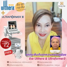 Ultherapy SPT