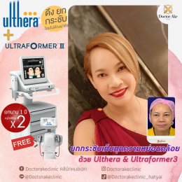 Ultherapy SPT