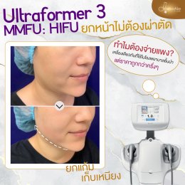 Ultraformer III