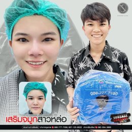 เสริมจมูกสาวหล่อ 