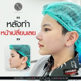 จมูกสาวหล่อ 