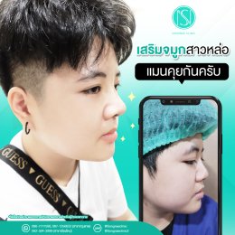 รีวิวเสริมจมูกทอม
