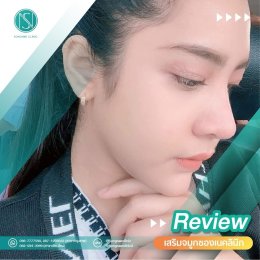 รีวิว SongnaeClinic