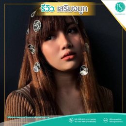  รีวิวเสริมจมูก17_ทรงจมูกสวยสุดๆ
