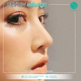 รีวิวเสริมจมูก31_CLOSE_UP_ขนาดนี้_ยังสวยเป๊ะเลยค่ะซิส