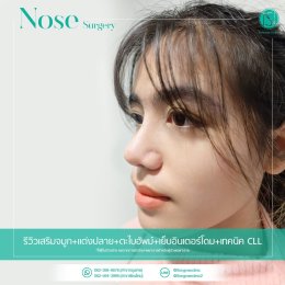 รีวิวเสริมจมูก_ซิลิโคนเกรดพรีเมี่ยม