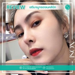 รีวิวเสริมจมูกผู้หญิง