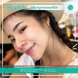 รีวิวเสริมจมูก ผู้หญิง