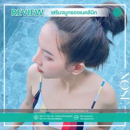 รีวิวเสริมจมูก ผู้หญิง