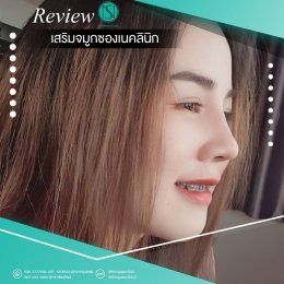 รีวิวเสริมจมูก ผู้หญิง