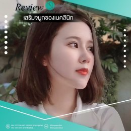 รีวิวเสริมจมูกผู้หญิง SongnaeClinic