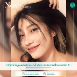 รีวิวเสริมจมูก + แต่งปลาย + ตะไบฮัพม์ + เย็บอินเตอร์โดม + เทคนิค CLL