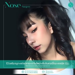รีวิวเสริมจมูก + แต่งปลาย + ตะไบฮัพม์ + เย็บอินเตอร์โดม + เทคนิค CLL