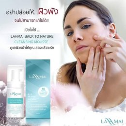วิธีรักษาสิว สิวอักเสบ หน้าเป็นสิว