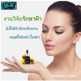 วิธีรักษาฝ้า แก้ฝ้า รักษษฝ้าแบบธรรมชาติ