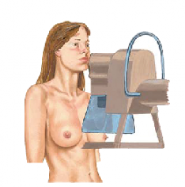 PAGET’S DISEASE OF THE BREAST