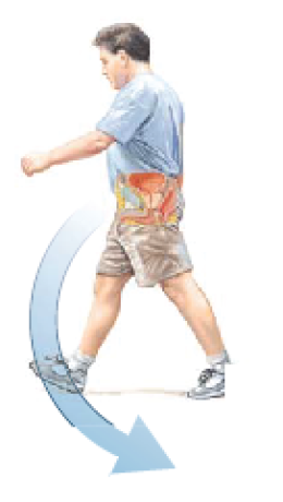 ENLARGED PROSTATE