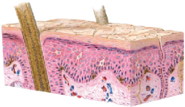 basal cell carcinoma มะเร็งเซลล์ต้นกำเนิด