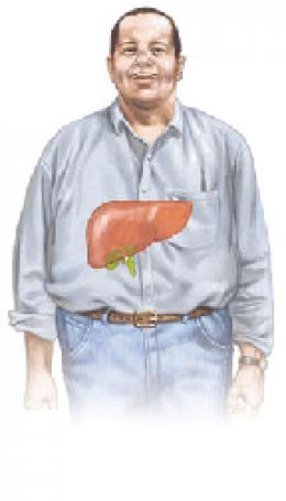 ไขมันพอกตับ(fatty liver disease)