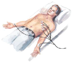 myocarditis