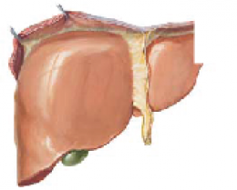 ไขมันพอกตับ(fatty liver disease)